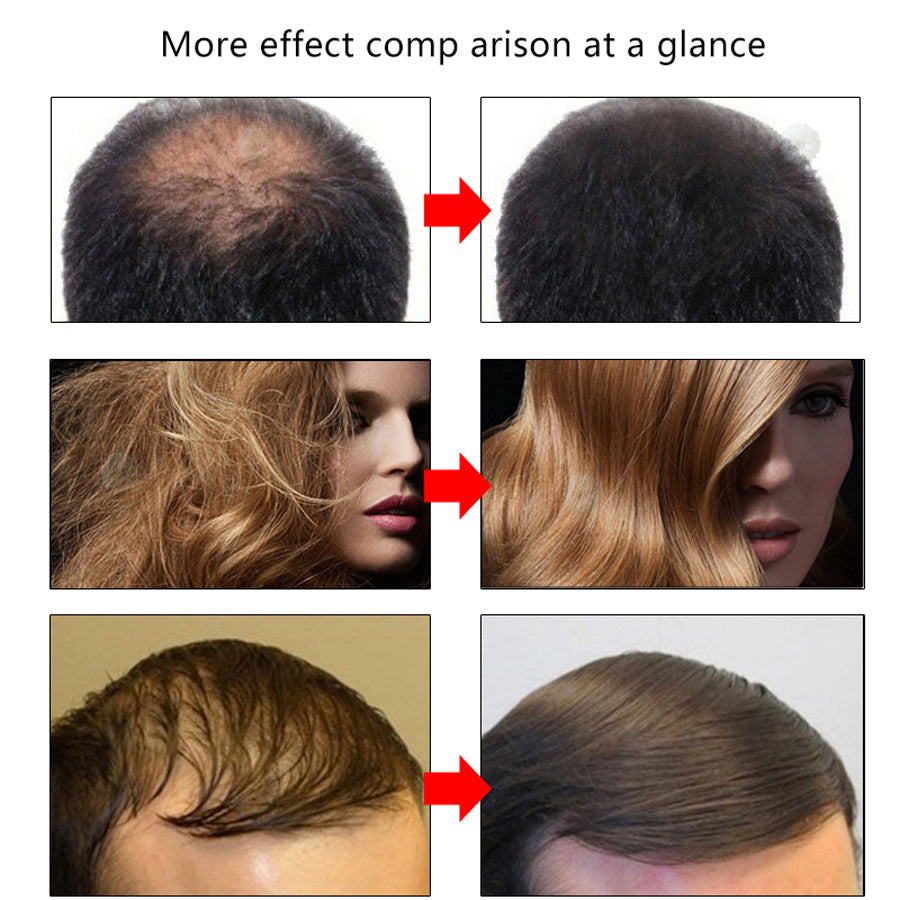 Efero Hair Growth Serum for Stronger Roots and Length