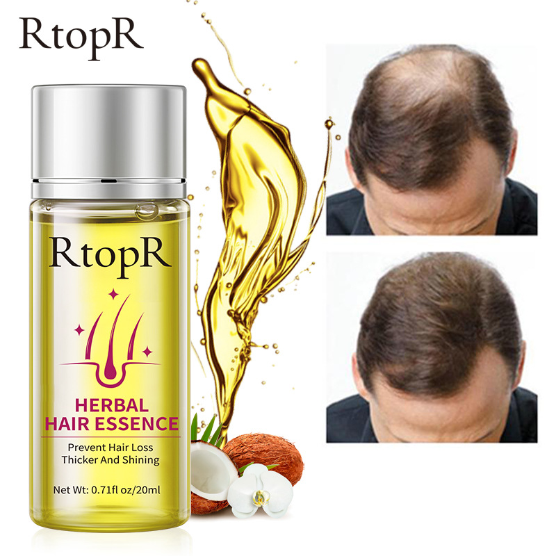 RtopR Herbal Hair Oil for Hair Growth and Nourishment