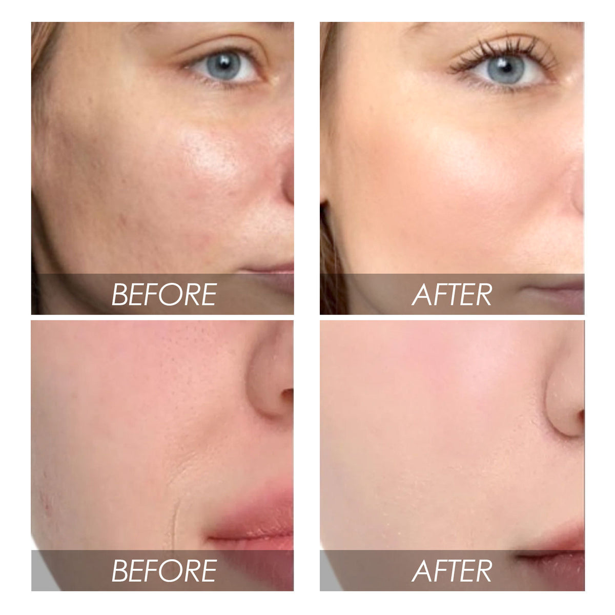 EELHOE Avocado Watermelon Facial Essence for Skin Care